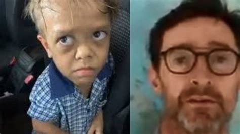 bullied dwarf gucci|Quaden Bayles: Australian boy in bullying video receives global .